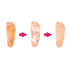 Exfoliační ponožky na zrohovatělou kůži