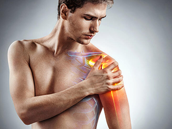 Co je syndrom zmrzlého ramene, jak vzniká a jak se léčí
