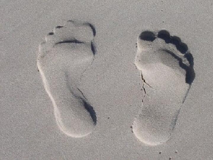 Jak na ploché nohy: příčiny, prevence a léčba