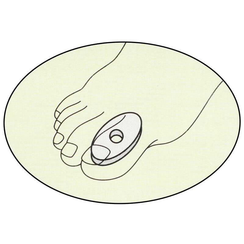 Chránič na otlaky samolepící –  malý gelový, 6 ks