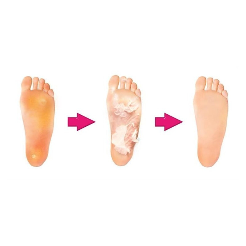 Exfoliační ponožky na zrohovatělou kůži